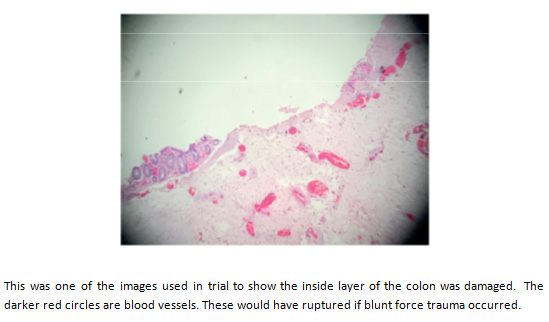 microscopic blood vessels